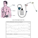 Holter or Ambulatory electrocardiography device(24시간 심박동 측정기) 이미지