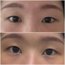 뷰티라인업 | 강남역피부관리 잘하는 곳 찾는다면 ? 비대칭 고민에 딱이었던 뷰티라인업 강남역 에스테틱 후기