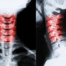 화정탑한의원 이미지