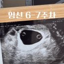 새봄산부인과의원 | 차 / 난황 확인 / 심장소리 확인 / 파이널임테기 / 서브병원 / 하단 권현영 산부인과의원 / 에디스여성병원