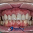 바른손치과기공소 네이버블로그