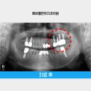 용인플란트치과의원 이미지
