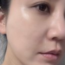 신사약국 | 프락셀 후 무너진 피부장벽을 위한 약국 화장품 셀트리온 지피덤 EGF크림 후기