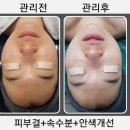 CU전주고려병원점 | 전주 중화산동 피부관리 오은에스테틱 ｜제품 알러지 있는 고객님도 안심하고 받은 관리 후기