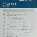천안 김안과 천안역본점의원 원데이라섹 가격 / 경과 / 수술후기
