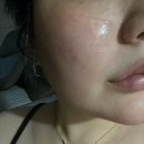 (주)아성다이소 부산동래역점 | 다이소 품절템 니들샷50 리얼 후기 / 니들샷 콜라겐 나도 써봤다!!