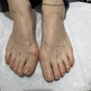 매료네일 문제성전문점 이미지