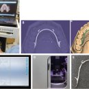 STL치과기공소 이미지
