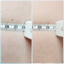 케어핏 | 청라팔뚝관리 고주파테라피 + 앰플 빼빼핏케어 받고 온 리얼 후기 [리바디라인]