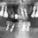 (주)바이콘임플란트 이미지