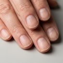 원케어팜 | 손톱세로줄 케어 후기 좋은 영양제 추천