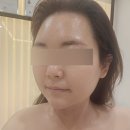 위드미 평택포승점 | [평택/비전동] '위드미 평택점' 민감성 피부 케어 리얼 후기 (+혐오 사진 주의)