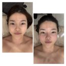 신촌 수라움에스떼 복부 디톡스, 수족냉증과 전신 붓기 싹 잡는 순환 관리/디엘 더 아로마 후기