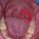 차지킴이 | 편도선염에 좋은 음식, 차 기관지 지킴이[좋은습관 삼백초 맥스98] 후기