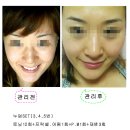 (주) 이노페이스