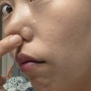 모팩 | 쏙모팩 후기 찾아보는 이유, 소극성 속모증이 뭐길래