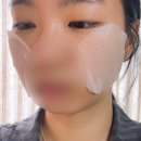 늘바름 | 매일바름 어성초 트러블 진정 토너패드 어성초 토너패드 추천 지성 여드름 피부 실사용 후기