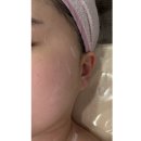 위례피부관리샵 올가드림뷰티 위례송파점 | 칙칙한 안색과 다크서클 고민 해결! 비타웨이브 솔직후기