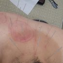 내수한의원 이미지