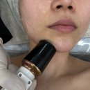 고무래로 6-7 | [반포 피부샵] 반하연 뷰티 스튜디오 탄력업 하이푸리프팅