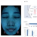 몬스터의원 | 코모공 축소 시술 포텐자 후기 및 부작용, 가격, 내돈내산