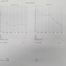청력그래프 입니다. 보청기에 대한 조언 좀 부탁드립니다. 이미지