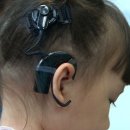 독일지멘스보청기 이미지