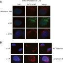 SirT3 is a nuclear NAD+-dependent histone deacetylase that translocates t 이미지