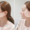 플래닛성형외과의원 | 미니거상후기, 성형외과 전문의가 반대하는 이유