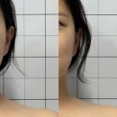 부산 두골비/두골체 관리로 체형개선하는, 로온 얼굴안면비대칭&amp;자이로토닉