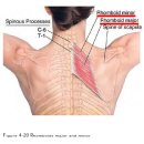 ♠ 소능형근(작은마름근) 대능형근(큰마름근) RHOMBOIDS [MINOR AND MAJOR] 이미지