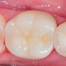 본치과기공소 이미지