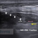수신경과의원 네이버블로그