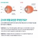 씨채널안경 콘택트 안동점 네이버블로그