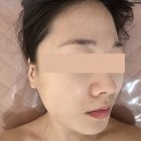 시온네일 | 사당 체형관리 시온네일 윤곽관리로 V라인 찾은 후기