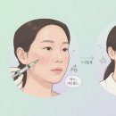 미주광택