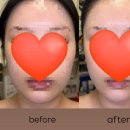 대평로90번길 | 수원 정자동 | 피부관리 맛집 얼굴 윤곽 바네피부앤왁싱 솔직후기