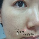 천연장 | id 피부과의 관리를 집에서 그대로 아이디화장품 석고팩 모공수축에 최고다