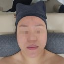 데이지 | 울산 온다 웨이브온 리프팅 뷰티데이지 이중턱 리얼 변화 후기