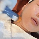 바비 | 포텐자 시술 고민? 바비톡 후기 보고 바로 예약했어요.