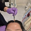 강성로 | 일산두피관리 다나오두피탈모센터 방문 시술 후기 샴푸 구매