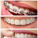 다산센트럴치과교정과치과의원 | 다산신도시교정치과, 놓치기 쉬운 핵심 포인트