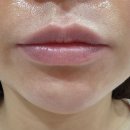 디아트의원 이미지