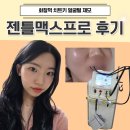 천호피부과 젠틀맥스프로 플러스 얼굴제모 하고 온 만족 후기
