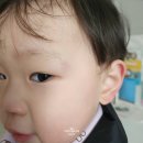 보라약국 | 아기 얼굴 멍크림 사용해되 될까? 약국 가격·성분·벤트플라겔 vs 타바겐겔 비교 후기