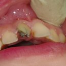 거성치과기공소 이미지