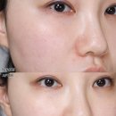 올영세일 모공패드 수분앰플 추천 더마토리 블랙패드 히알샷 앰플 정식으로 때 빼고 광 낸 후기