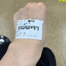 강동웰빙약국 | 새열낭종 증상 시술 비용 병원후기