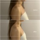 양산-중부-5-7-001 | 양산에스테틱 양산웨딩관리 신부관리 추천 오월에스테틱