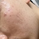 트루션 센시톨로지 더마 크림 리뷰(광고X,내돈내산)